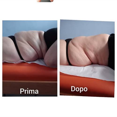 Massaggi